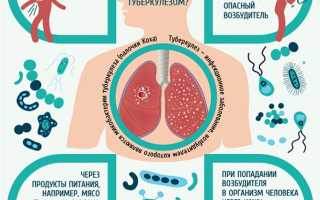 Туберкулез лимфоузлов – опасное заболевание иммунной системы