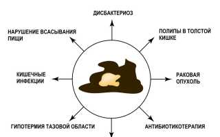 Слизь в кале: причины и лечение