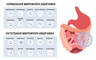 Почему кал приобретает зеленый цвет