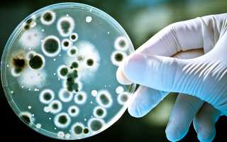Что это за бактерия enterococcus faecalis?