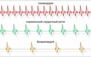 Учащенный пульс – симптом различной патологии