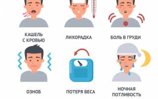 Ночная потливость