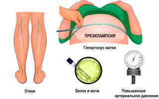 Гипертонус матки при беременности