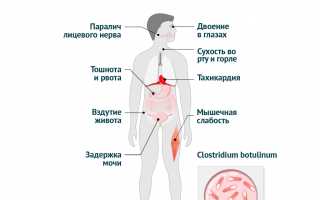 Вялость в мышцах