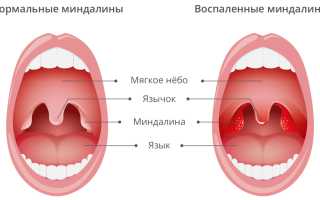 Налёт на миндалинах