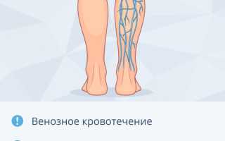 Тяжесть в ногах: причины и лечение