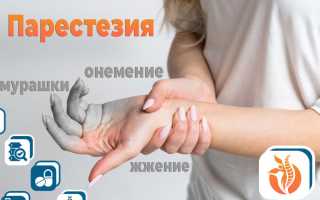 Парестезия (нарушение чувствительности)