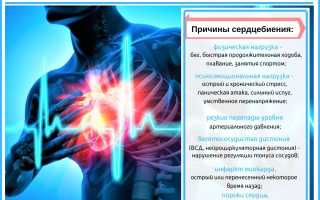Тахикардия (учащенное сердцебиение)