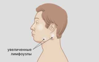 Воспаление лимфоузлов возле ушей