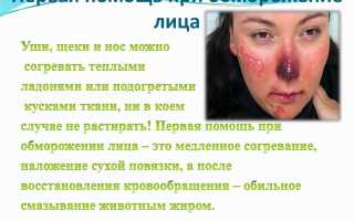 Неотложная помощь при обморожении носа