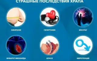 Храп как следствие вредных привычек