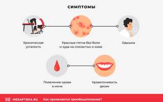 Тромбоцитопения: причины и лечение