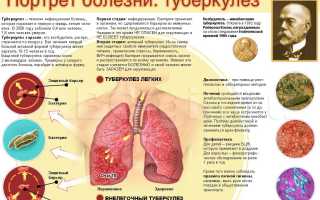 Туберкулезный менингит – опасное осложнение туберкулеза