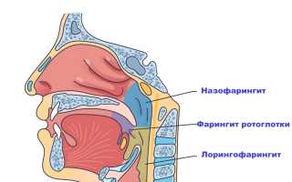 Ринофарингит (воспаление носоглотки): почему возникает и в чем опасность?