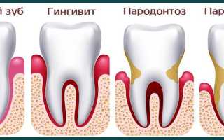 Пародонтолог: чем занимается и какие болезни лечит