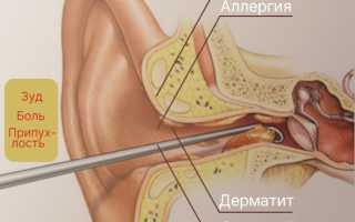 Почему возникает зуд в ушах: причины и лечение