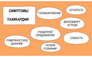 Тахикардия: причины и лечение