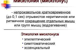 Непроизвольные сокращения мышц (миоклонии): почему возникают и как устранить