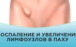 Что делать если воспалились лимфатические узлы в паху