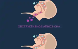 Как бороться с храпом: методы диагностики и лечения