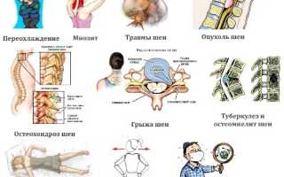 Причины боли в шейных лимфатических узлах и методы диагностики