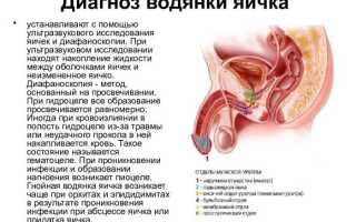 Диафаноскопия мошонки: суть метода исследования