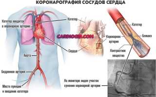 Кардиография сердца: суть и возможности исследования