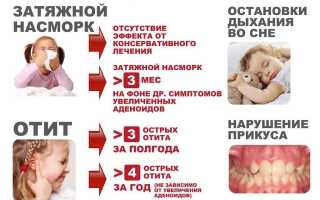 Почему возникает храп у ребенка с разрастанием аденоидов