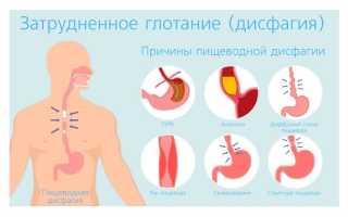 Нарушение глотания (дисфагия)