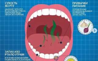 Галитоз – неприятный запах изо рта