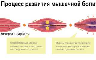Миалгия – мышечные боли