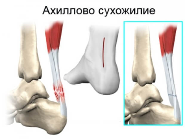 Процесс Как происходит