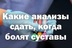 Какие анализы сдать, когда болят суставы Какие анализы сдать, когда беспокоят суставы