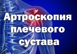Рентген Снимок