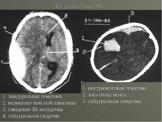 Диагностика КТ диагностика