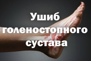Нога Как выглядит