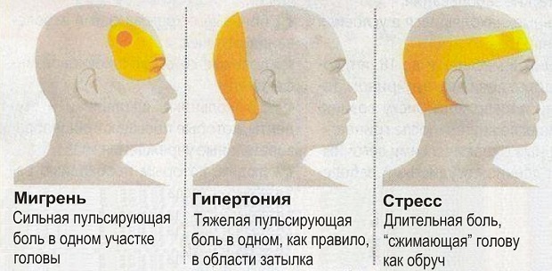 Какие бывают Виды