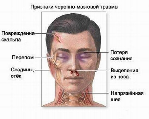 Признаки Симптомы