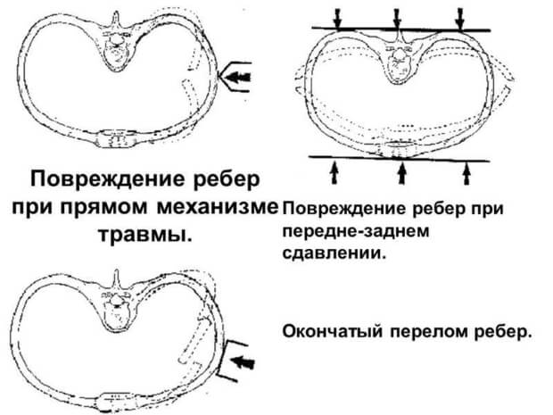 Схема повреждения Схема