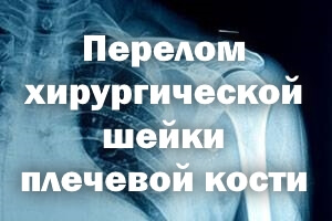 Перелом хирургической шейки плеча Перелом хирургической шейки плечевой кости