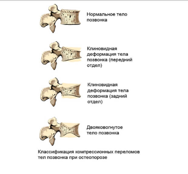 Какие бывают Виды