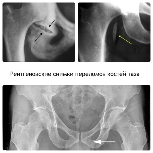 Снимки Рентгеновские снимки
