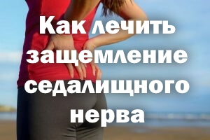 Поменять Как лечить защемление седалищного нерва