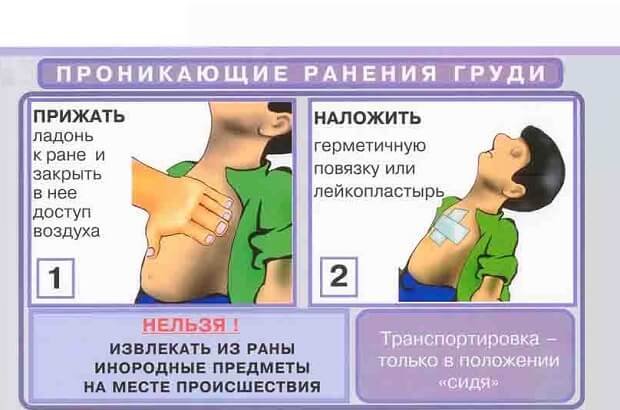Помощь Первая помощь