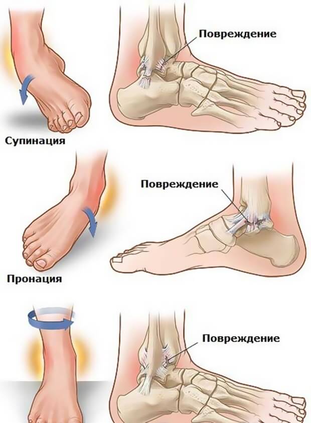 Повреждение Сущность