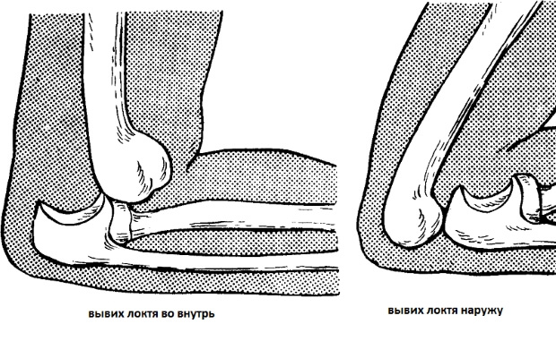 Травма Ребенок