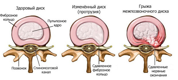 Схема Описание