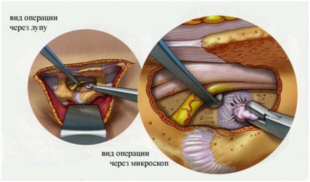 Исследование Под микроскопом