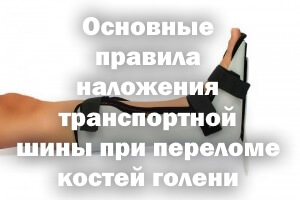 Простые правила наложения транспортной шины при переломе костей голени Правила наложения транспортной шины при переломе костей голени