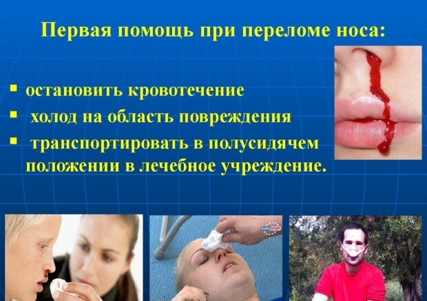Помощь Первая помощь